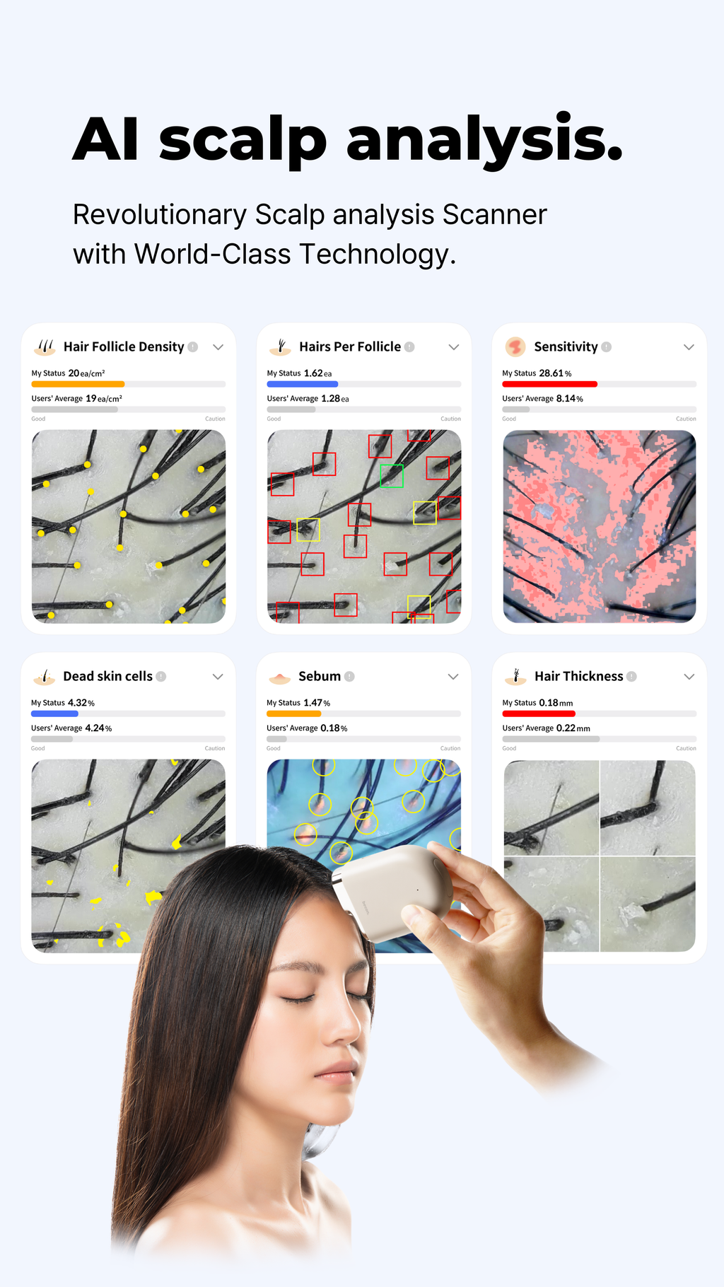 AI scalp analysis. Revolutionary Scalp analysis Scanner with world-class technology. The image shows thumbnail images of scans of hair follicles, sensitivity, skins cells, and hair thickness. There is another image of the scalp scan being performed on someone using the Scalp analysis scanner.